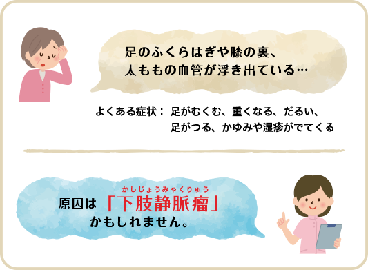 原因は「下肢静脈瘤」 かもしれません。